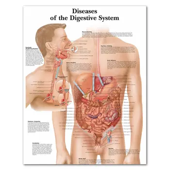 Virškinimo Sistemos Nuotraukas Anatomijos Diagramas Ir Plakatai Anatomija Diagramos Ligų Sienos Nuotraukas Medicinos Mokslo Daktarai