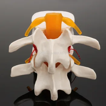 Dantų 1:1 Žmogaus anatomija skeletas Stuburo Juosmens Disko Herniation Mokymo Modelį