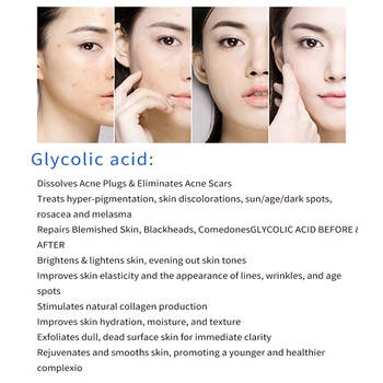 Glikolio rūgštis 30% 5ml kosmetikos medicinos aha odos glicolic atgal spuogai veido, šiurkštus Pašalinti Uždarytas spuogai gėrimų Šlakelis šviesos senėjimo