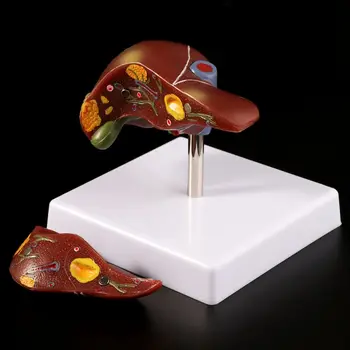 Žmogaus Kepenų Patologijos Anatomijos Modelis Anatomija Mokyklos Medicinos Mokymo Rodyti Priemonė, Laboratorijų Įranga Kepenų Modelis