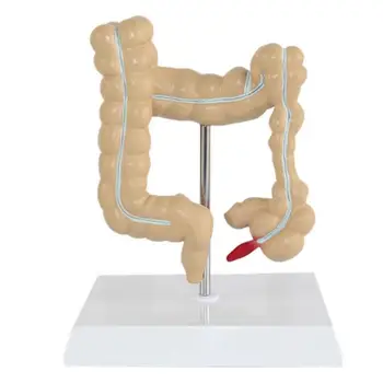 Storosios žarnos pažeidimas modelio žmogaus gaubtinės žarnos gyvatė storosios žarnos patologijos ligų modelio medicinos organizatorius anatomija